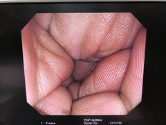 Video Colonoscope｜PCF-Q260AI｜Olympus Medical Systems photo6