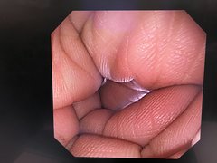 上部消化管汎用ビデオスコープ｜GIF-XP240｜オリンパスメディカルシステムズ株式会社の写真6枚目