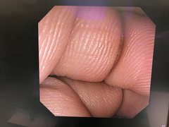 十二指腸ビデオスコープ｜JF-240｜オリンパスメディカルシステムズ株式会社の写真6枚目