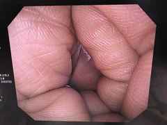 上部消化管汎用ビデオスコープ｜GIF-Q260｜オリンパスメディカルシステムズ株式会社の写真6枚目