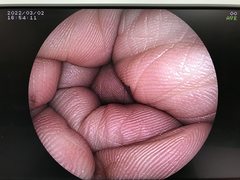 Video Colonoscope｜EC-3000MP｜Fujifilm Medical photo6