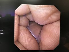 上部消化管汎用ビデオスコープ｜GIF-XQ260｜オリンパスメディカルシステムズ株式会社の写真6枚目