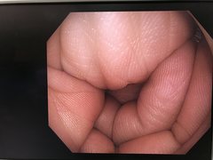 大腸ビデオスコープ｜CF-HQ290ZI｜オリンパスメディカルシステムズ株式会社の写真6枚目