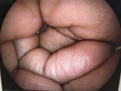 Video Transnasal Gastroscope｜EG-530NW｜Fujifilm Medical photo6