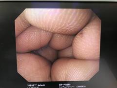 Video Gastroscope｜GIF-PQ260｜Olympus Medical Systems photo6
