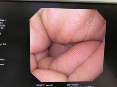 上部消化管汎用ビデオスコープ｜GIF-XQ260｜オリンパスメディカルシステムズ株式会社の写真6枚目