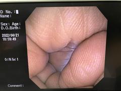 上部消化管汎用ビデオスコープ(径鼻)｜GIF-XP150N｜オリンパスメディカルシステムズ株式会社の写真6枚目