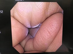 Video Gastroscope｜GIF-XQ240｜Olympus Medical Systems photo6