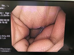 Video Gastroscope｜GIF-Q240X｜Olympus Medical Systems photo6