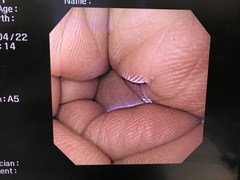 Video Gastroscope｜GIF-XQ260｜Olympus Medical Systems photo6