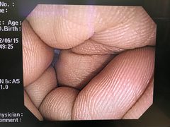 上部消化管汎用ビデオスコープ｜GIF-Q260J｜オリンパスメディカルシステムズ株式会社の写真6枚目
