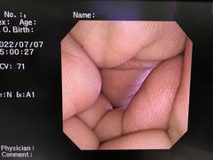 Video Gastroscope｜GIF-XP260｜Olympus Medical Systems photo6