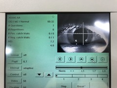 Automatic perimeter｜OCTOPUS 301｜Haag-Streit photo6