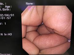 Video Gastroscope｜GIF-XQ240｜Olympus Medical Systems photo6