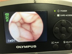 Airway mobile scope｜MAF TYPE TM｜Olympus Medical Systems photo6