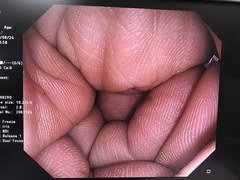 上部消化管汎用ビデオスコープ｜GIF-HQ290｜オリンパスメディカルシステムズ株式会社の写真6枚目