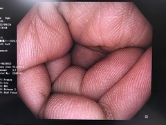 大腸ビデオスコープ｜CF-HQ290ZI｜オリンパスメディカルシステムズ株式会社の写真6枚目