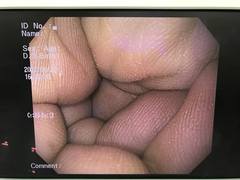 Video Gastroscope｜GIF-Q150X｜Olympus Medical Systems photo6