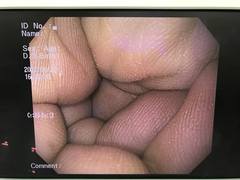 上部消化管汎用ビデオスコープ｜GIF-Q150X｜オリンパスメディカルシステムズ株式会社の写真6枚目