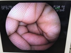 Video Colonoscope｜EC-250MP5｜Fujifilm Medical photo6