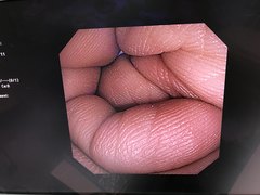大腸ビデオスコープ｜CF-240I｜オリンパスメディカルシステムズ株式会社の写真6枚目