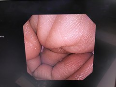 上部消化管汎用細経ビデオスコープ｜GIF-XP260｜オリンパスメディカルシステムズ株式会社の写真6枚目