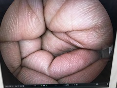 上部消化管用経鼻スコープ｜EG-580NW｜富士フイルムメディカルの写真6枚目