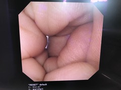 Video Gastroscope｜GIF-XQ240｜Olympus Medical Systems photo6