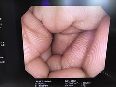 上部消化管汎用ビデオスコープ｜GIF-H260Z｜オリンパスメディカルシステムズ株式会社の写真6枚目