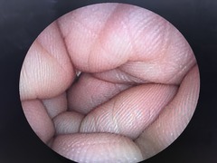 上部消化管用経鼻スコープ｜EG-3000N｜富士フイルムメディカルの写真6枚目