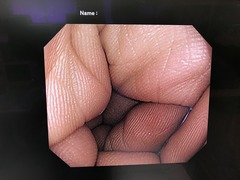 大腸ビデオスコープ｜PCF-Q260AZI｜オリンパスメディカルシステムズ株式会社の写真6枚目