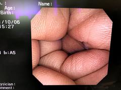 大腸ビデオスコープ｜CF-240AI｜オリンパスメディカルシステムズ株式会社の写真6枚目