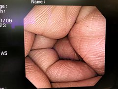大腸ビデオスコープ｜CF-240AI｜オリンパスメディカルシステムズ株式会社の写真6枚目