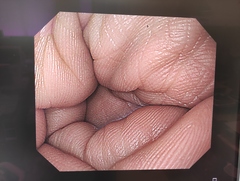 上部消化管汎用ビデオスコープ｜GIF-Q260｜オリンパスメディカルシステムズ株式会社の写真6枚目