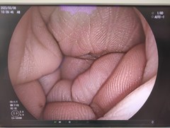 Video Transnasal Gastroscope｜EG-580NW｜Fujifilm Medical photo6