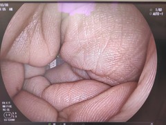 Video Transnasal Gastroscope｜EG-530NW｜Fujifilm Medical photo6