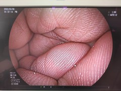 Video Transnasal Gastroscope｜EG-580NW｜Fujifilm Medical photo6