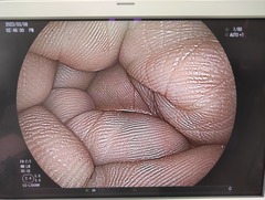 上部消化管用経鼻スコープ｜EG-L580NW｜富士フイルムメディカルの写真6枚目