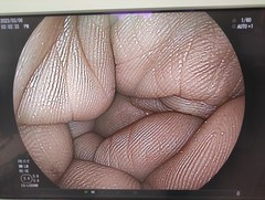 上部消化管用経鼻スコープ｜EG-L580NW｜富士フイルムメディカルの写真6枚目