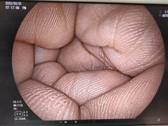 上部消化管用経鼻スコープ｜EG-580NW｜富士フイルムメディカルの写真6枚目
