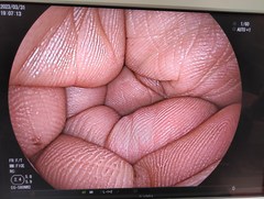 上部消化管用経鼻スコープ｜EG-580NW2｜富士フイルムメディカルの写真6枚目