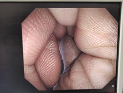 上部消化管汎用ビデオスコープ｜GIF-HQ290｜オリンパスメディカルシステムズ株式会社の写真6枚目