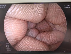 上部消化管用汎用ビデオスコープ｜EG-L590WR｜富士フイルムメディカルの写真6枚目