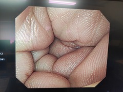 上部消化管汎用ビデオスコープ｜GIF-Q260｜オリンパスメディカルシステムズ株式会社の写真6枚目