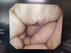 上部消化管汎用ビデオスコープ｜GIF-H290Z｜オリンパスメディカルシステムズ株式会社の写真6枚目