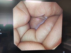 上部消化管汎用ビデオスコープ｜GIF-XP290N｜オリンパスメディカルシステムズ株式会社の写真6枚目