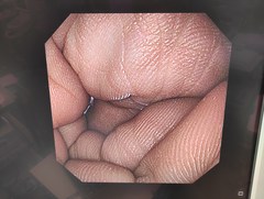 上部消化管汎用ビデオスコープ｜GIF-XP290N｜オリンパスメディカルシステムズ株式会社の写真6枚目