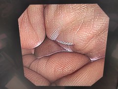 上部消化管経鼻ビデオスコープ｜GIF-N260｜オリンパスメディカルシステムズ株式会社の写真6枚目