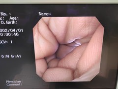 Video Gastroscope｜GIF-XQ260｜Olympus Medical Systems photo6