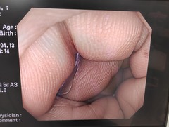 大腸ビデオスコープ｜CF-H260AZI｜オリンパスメディカルシステムズ株式会社の写真6枚目